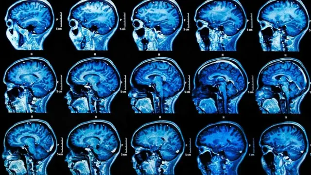 قد يؤدي التعرض لمواقف تتسم بالتوتر والضغط النفسي إلى تنشيط فيروس الهربس