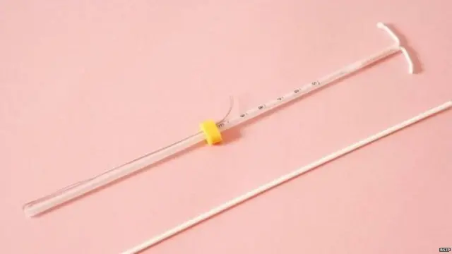 પ્રતીકાત્મક તસવીર