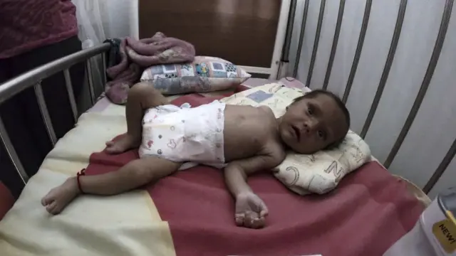 वेनेजुएला में कुपोषण भी बड़ी समस्या है, जिससे लोग निपट नहीं पा रहे हैं.