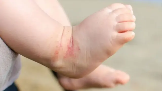 Yalangoch tanada erotik cosplay zirh