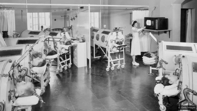 La polio a autrefois laissé des gens dans des conditions de vie difficiles, mais elle a été efficacement éliminée dans la nature grâce à un vaccin