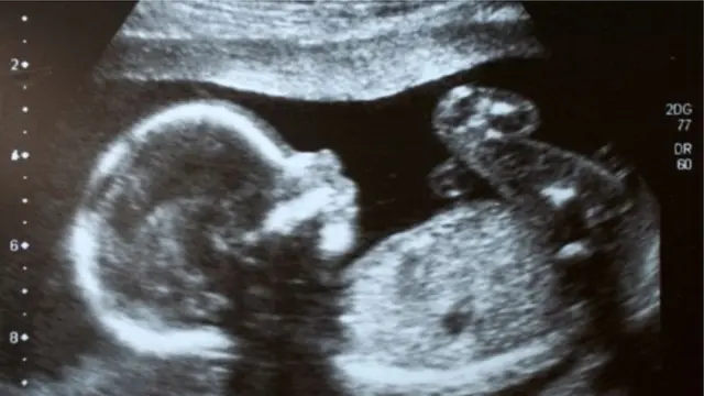 মায়ের পেটে ভ্রুণ অবস্থায়ং জিনগত পরিবর্তন সম্ভব?