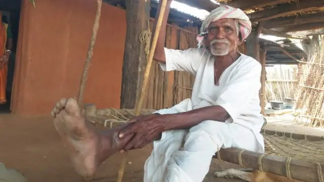 బుల్లెట్ గాయాన్ని చూపిస్తున్న వృద్ధుడు