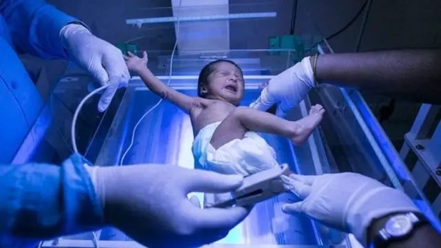 बच्चा को जन्म दिलाते डॉक्टर