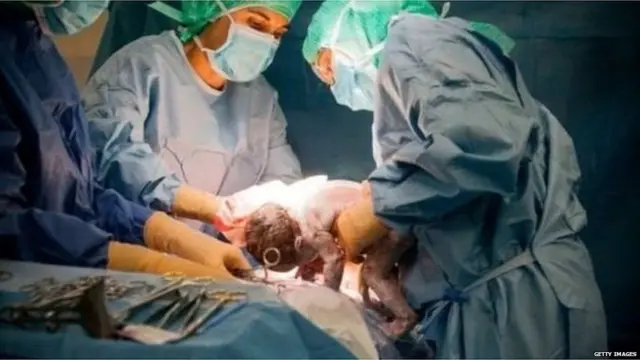 પ્રસૂતિની સાંકેતિક તસવીર