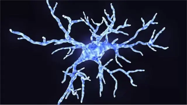 Les cellules gliales protègent et soutiennent les neurones. Lorsqu'un cancer se développe dans ces cellules, on parle de gliome.