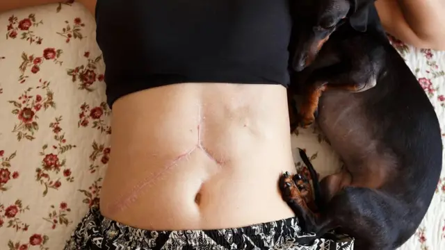 On espère que les études sur des animaux tels que la souris épineuse pourraient conduire à de nouveaux traitements médicaux susceptibles d'améliorer la guérison des patients