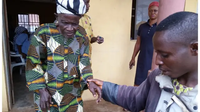 Baba agbalagba ti oju n yọ lẹnu