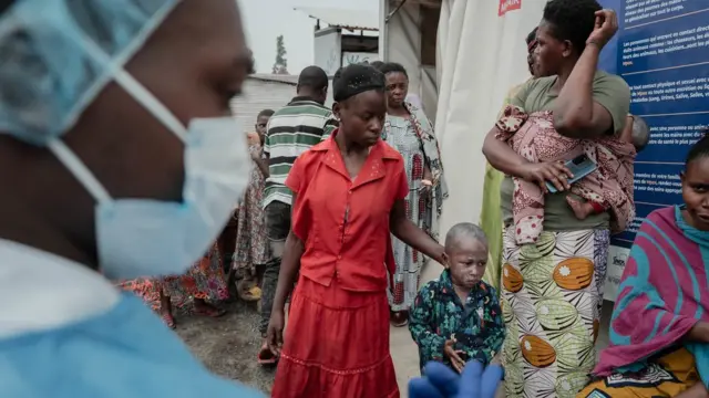 TOPSHOT - Patients wait for their turn to be seen by a doctor outside a consultation room at the Mpox treatment centre at Nyiragongo General Referral Hospital, north of Goma on August 17, 2024. With around 16,000 cases recorded since the beginning of the year, the DRC is the focus and epicentre of the epidemic that led the World Health Organisation (WHO) to trigger its highest level of alert at the international level on Wednesday. The province of South Kivu records around 350 new cases per week, according to Dr Justin Bengehya, epidemiologist at the provincial health division of South Kivu. Goma, capital of the province of North Kivu, almost surrounded by an armed rebellion and where hundreds of thousands of displaced people are crammed into makeshift camps, fears a large-scale spread due to promiscuity. (Photo by GUERCHOM NDEBO / AFP) (Photo by GUERCHOM NDEBO/AFP via Getty Images)