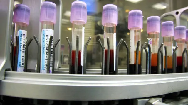 type 2 diabetes, Africa, blood test