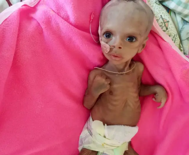 ወዲ ሰለስተ ወርሒ ህፃን ሱራፉኤል መዓርግ፡ ካብ መንጎ እቶም ኣብ 2022 ኣብ ትግራይ ብዋሕዲ ምግቢ ዝሞቱ ህፃናት እዩ