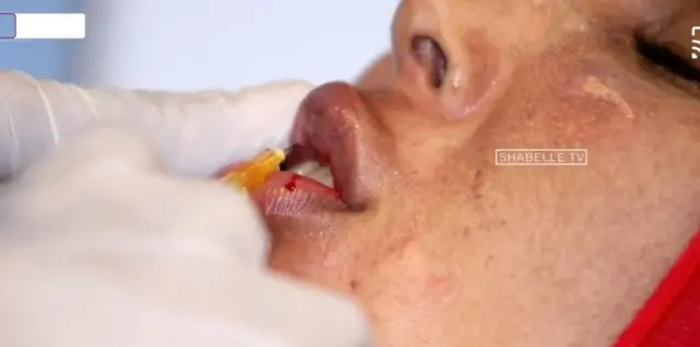 Gabdhaha qaar ee weyneysanaya faruuryaha ayaa qurux u arka