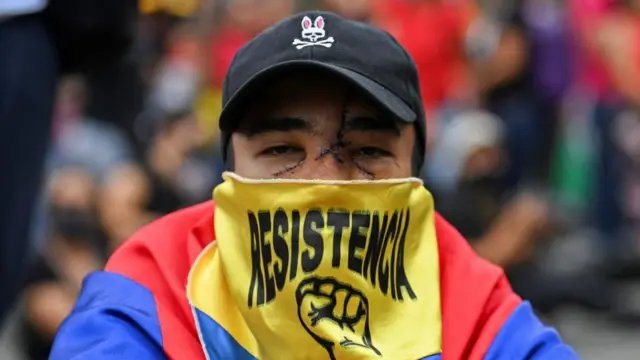Manifestante herido durante el estallido social de 2021, en la ciudad Cali. 