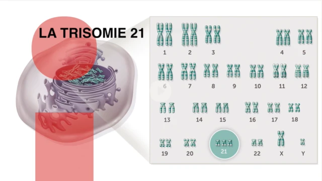 Illustration de 47 chromosomes 