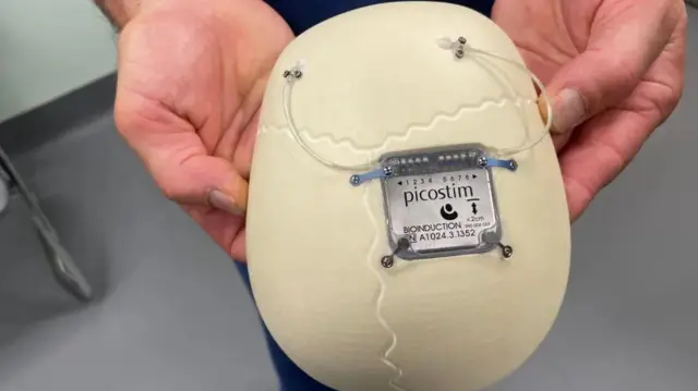 Kifaa hicho kinafungwa kwenye mfupa