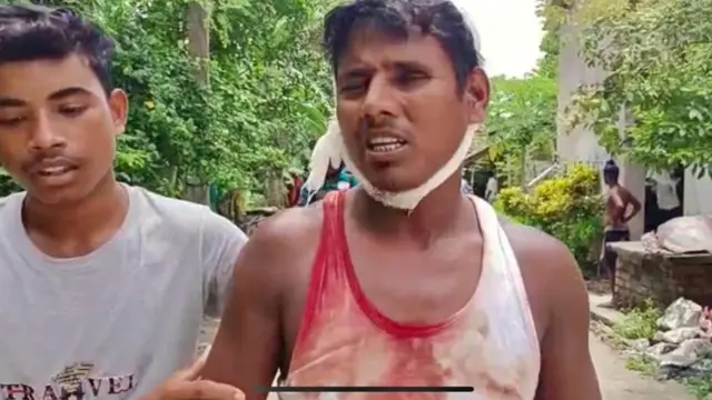 রক্ত ঝরতে শুরু করে সকাল থেকেই