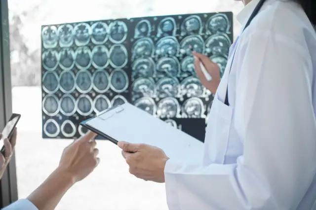 స్ట్రోక్ లక్షణాలు