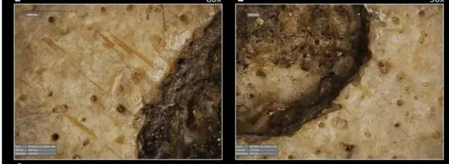 Les scientifiques ont découvert des lésions sur un crâne égyptien