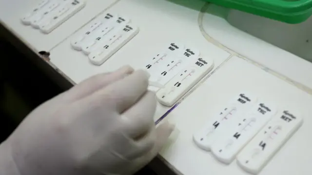 Petugas medis memeriksa sampel urine.