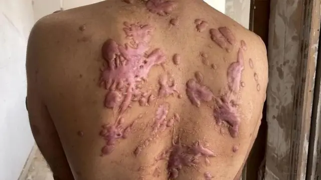 Mgongo wa Mohammad Abu Tawileh