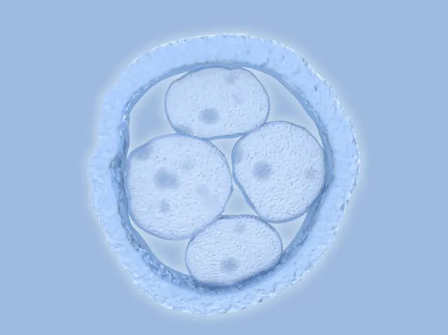 விந்தணு இன்றி, முட்டை இன்றி உருவான மனிதக் கரு 