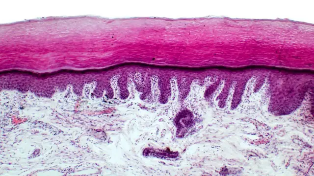 ኣልትራቫዮሌት ጩራታት ጸሓይ ኣብ ልዕሊ ቆርበትና ጉድኣት የስዕቡ