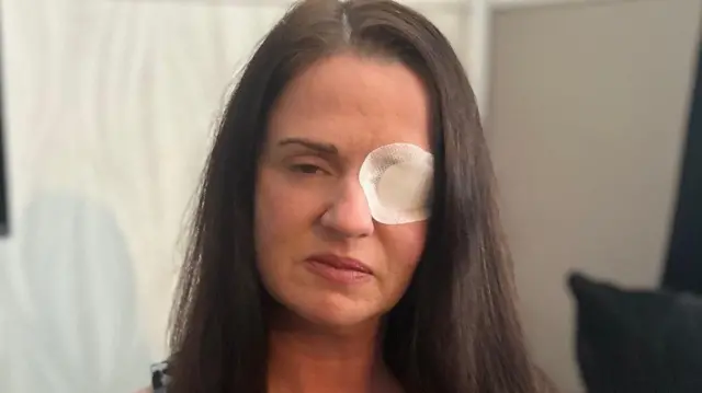 Kaylie Bailey com tapa-olho