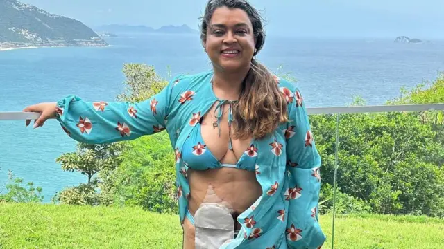 Preta Gil sorrindofastest withdrawal online casino nzjardim, com roupafastest withdrawal online casino nzpraia,fastest withdrawal online casino nzfrente ao mar; no abdômen, uma bolsafastest withdrawal online casino nzcolostomia