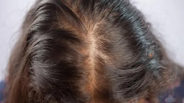 केस कसे वाढतात?