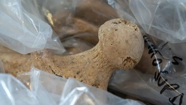 पोम्पेईमा फेला परेको अस्थिपञ्जरको एउटा तिघ्राको माथिल्लो भागको हड्डी