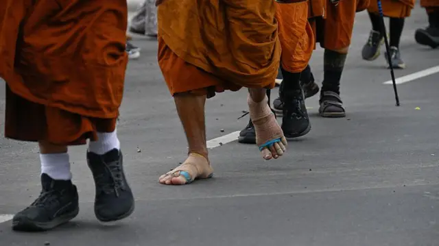 Ноги монахов в оранжевых одеяниях, у одного сильно повреждены стопы