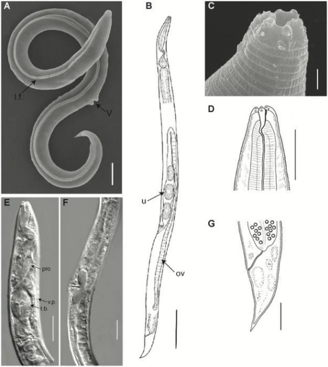 ภาพขยายร่างกายส่วนต่าง ๆ ของหนอนตัวกลม P. Kolymaensis