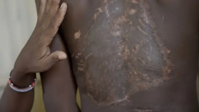 ካሌብ ምዋንጊ