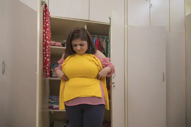 உடல் பருமன்