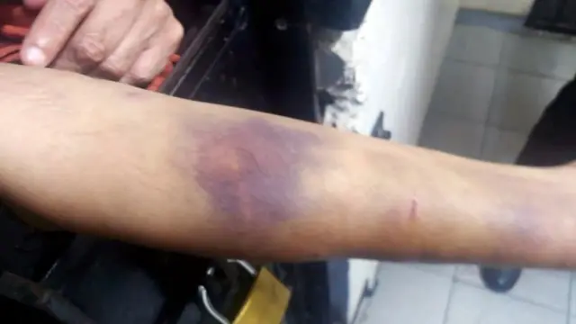 ఆంటిగ్వా పోలీసులుగా చెప్పుకుంటున్న కిరాయి హంతకులు తనను తీవ్రంగా హింసించారని చోక్సీ పేర్కొన్నారు.