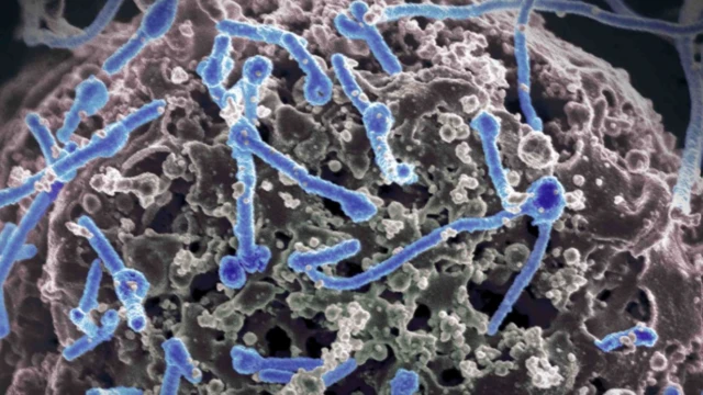 Bi kokoro aarun Ebola ṣe maa n ri ninu ara 