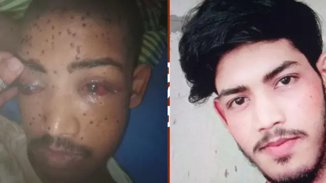 চোখে গুলি লেগে দৃষ্টি হারিয়েছেন আমজাদ
