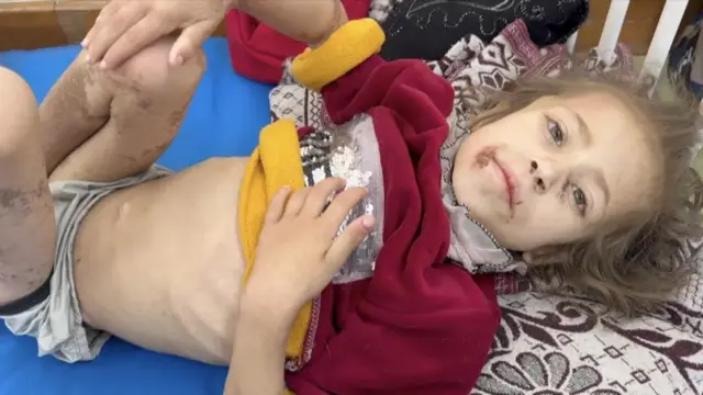 Jenna Ayyad yang berusia tujuh tahun mengalami trauma parah - dia telah dipindahkan ke Gaza selatan di mana dia menerima perawatan.