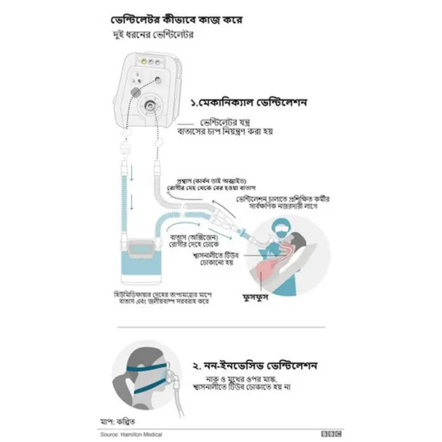 রোগীর ফুসফুস যদি কাজ না করে তাহলে রোগীর নিশ্বাস-প্রশ্বাসের কাজটা ভেন্টিলেটর করে দেয়।
