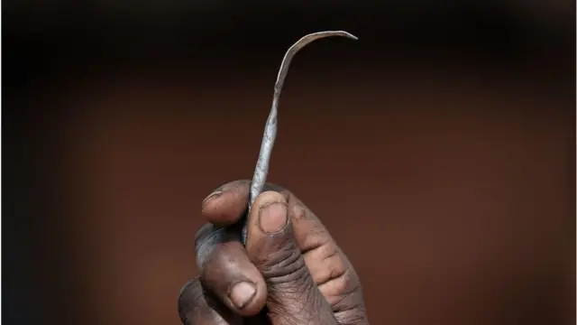 من أدوات الختان