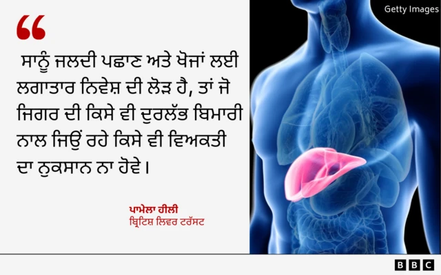 ਬ੍ਰਿਟਿਸ਼ ਲਿਵਰ ਟਰੱਸਟ ਦੀ ਪਾਮੇਲਾ ਹੀਲੀ ਦਾ ਬਿਆਨ