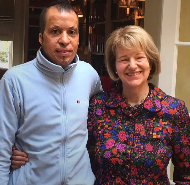 అమర్, ఎమ్మా