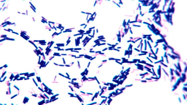 Bacterias grampositivas y gramnegativas
