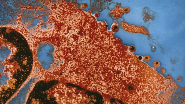 এইচআইভি ভাইরাস