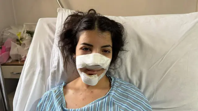 امرأة شابة ذات شعر داكن وضمادات حول وجهها تجلس على سرير المستشفى