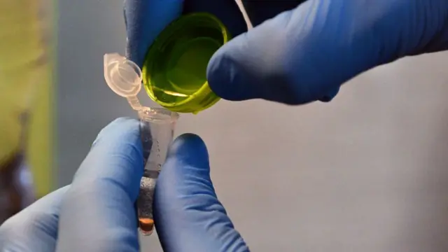 ਸੰਕੇਤਕ ਤਸਵੀਰ