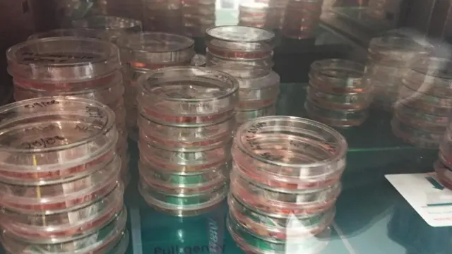 تطوير أدمغة مصغرة خارج الجسم