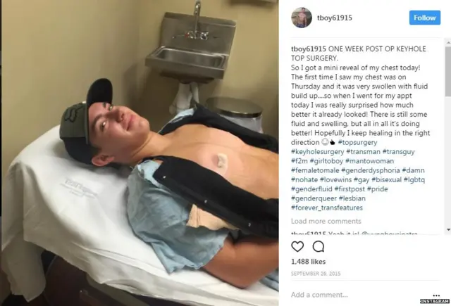 ट्रांसजेंडर, लड़का, लड़की, एलजीबीटी