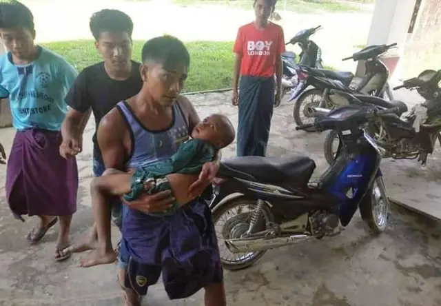 ဘယ်လက်အရိုးကို ကျည်စဖောက်ဝင် ဒဏ်ရာရ