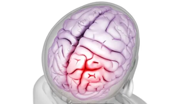 سردردها میتوانند به شدت دردآور باشند